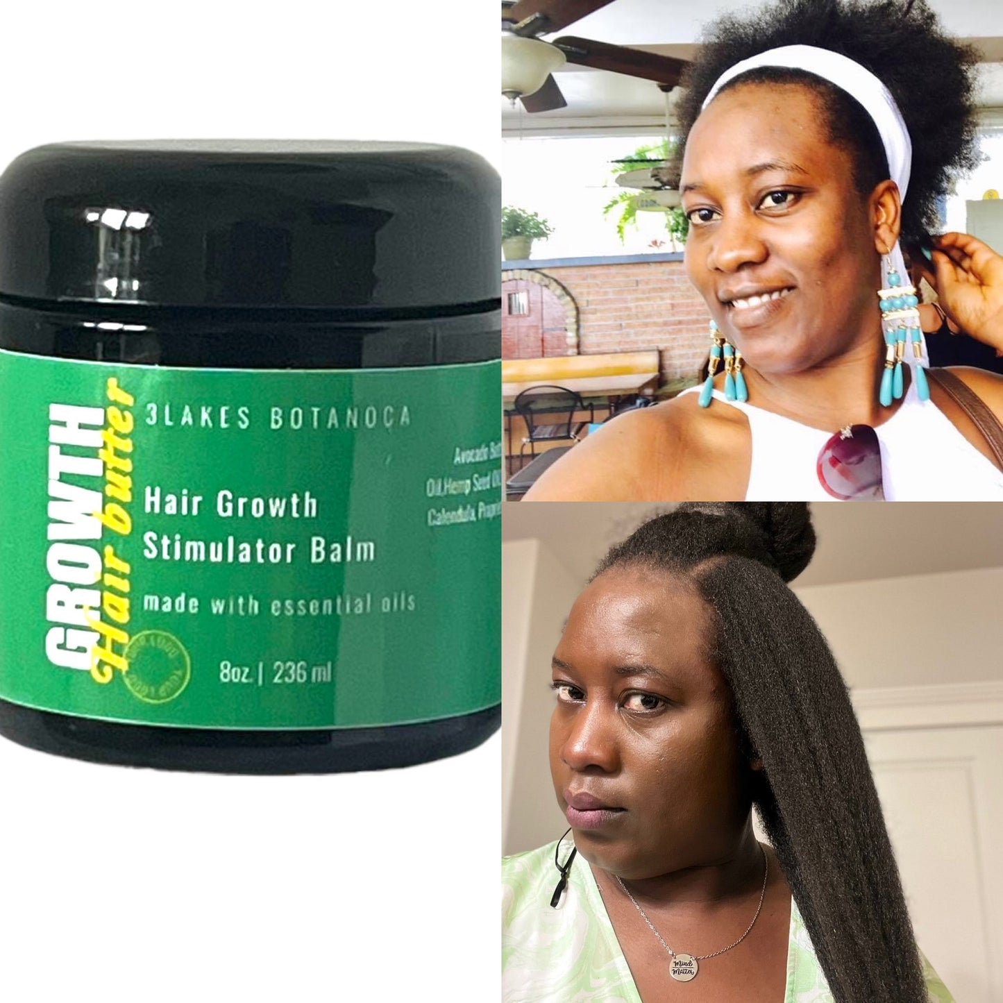 5 Jars Hair Growth Stimulator Balm/Grease